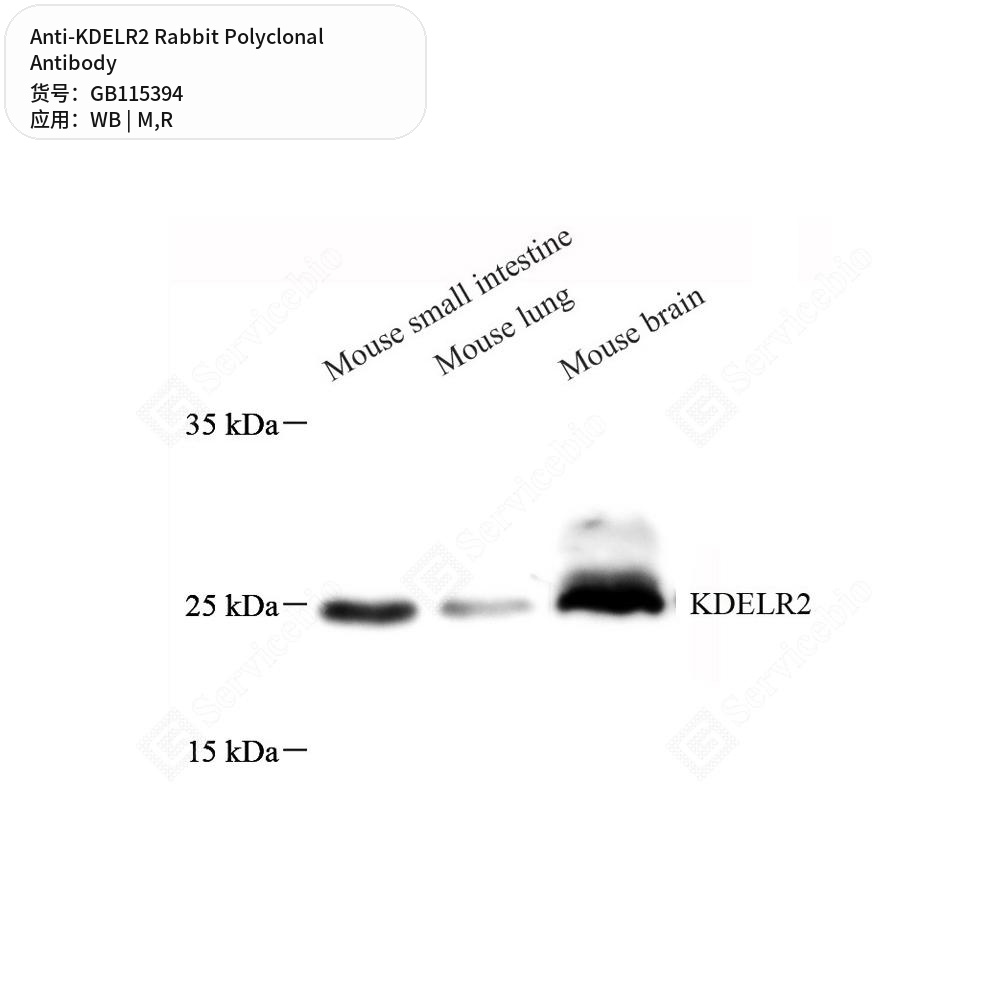 Антитела первичные, поликлональные кролика к KDELR2 крысы, мыши, 50 мкл