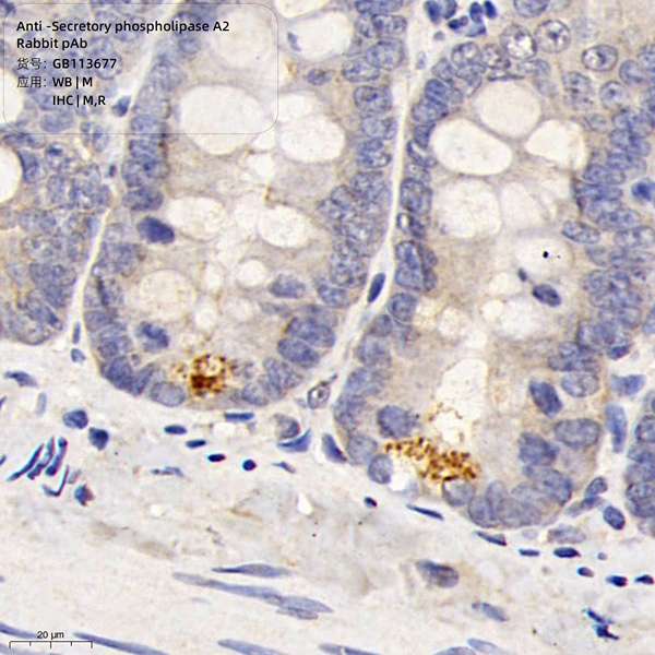 Антитела первичные, поликлональные, Secretory phospholipase A2, 100 мкл