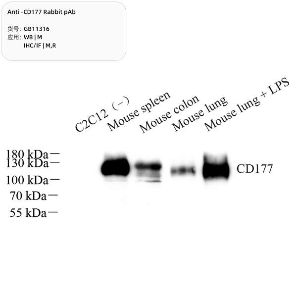 Антитела первичные, поликлональные, CD177, 100 мкл