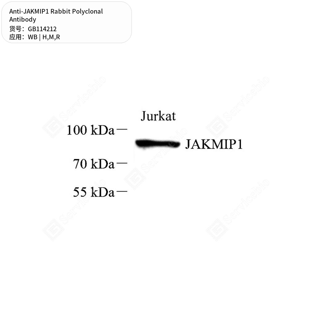 Антитела первичные, поликлональные кролика к JAKMIP1 крысы, мыши, человека, 100 мкл