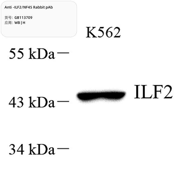 Антитела первичные, поликлональные, ILF2/NF45, 100 мкл
