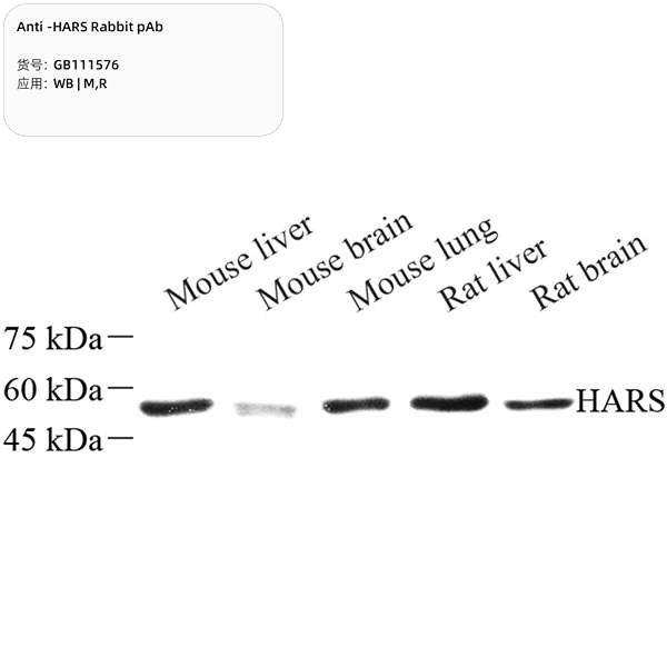 Антитела первичные, поликлональные, HARS, 100 мкл