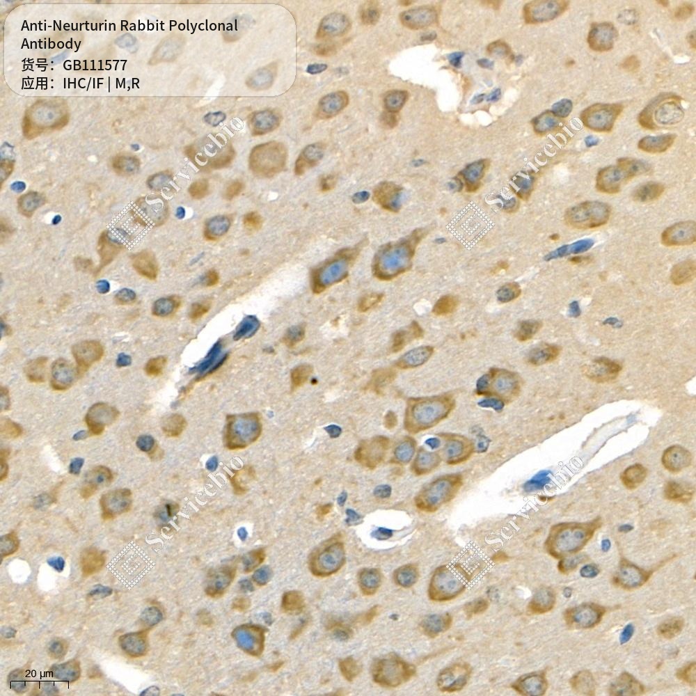 Антитела первичные, поликлональные кролика к Neurturin крысы, мыши, 100 мкл