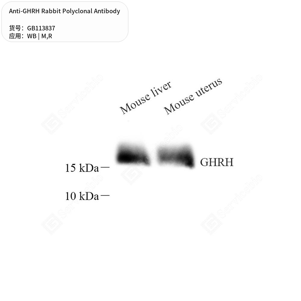 Антитела первичные, поликлональные кролика к GHRH крысы, мыши, 50 мкл