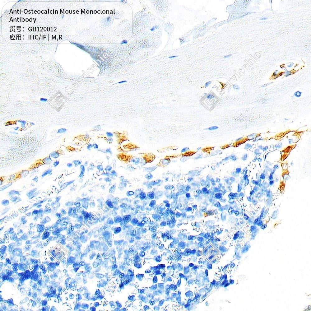 Антитела первичные, моноклональные мыши к Osteocalcin крысы, мыши, 50 мкл