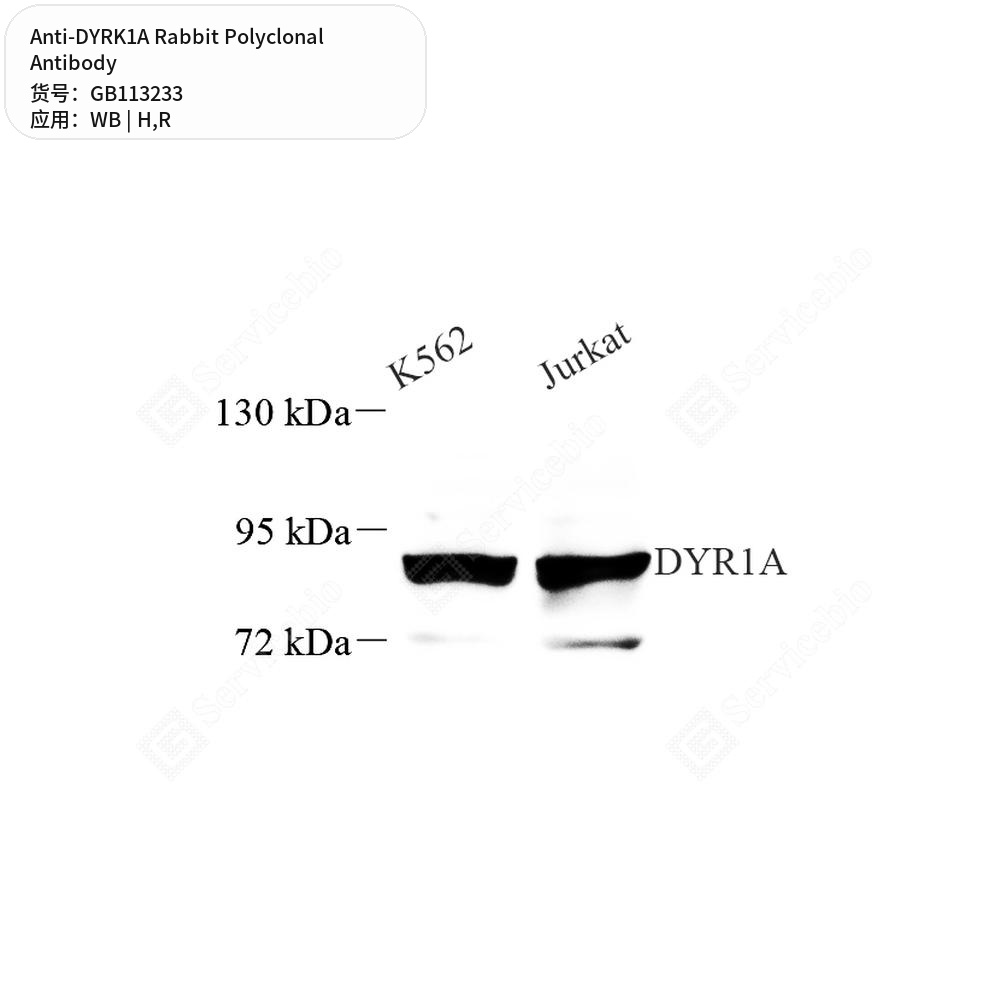 Антитела первичные, поликлональные кролика к DYRK1A крысы, человека, 100 мкл