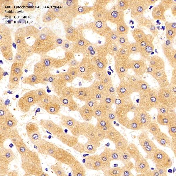 Антитела первичные, поликлональные, Cytochrome P450 4A/CYP4A11, 100 мкл