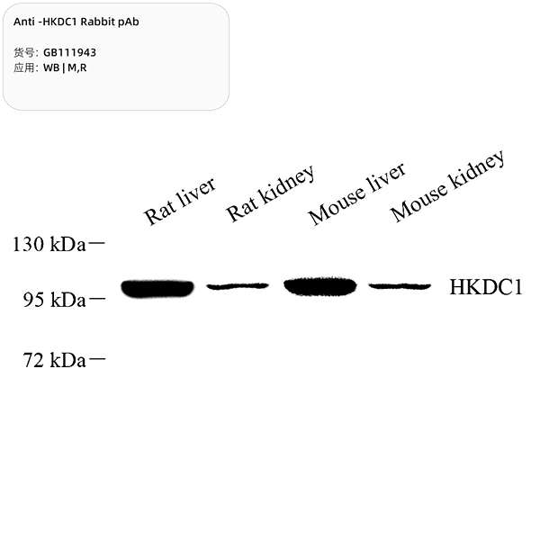 Антитела первичные, поликлональные, HKDC1, 100 мкл