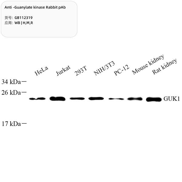 Антитела первичные, поликлональные, Guanylate kinase, 100 мкл