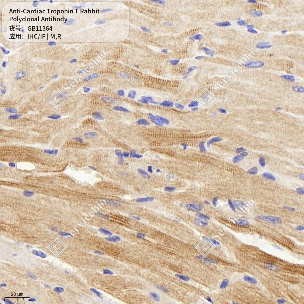 Антитела первичные, поликлональные кролика к Cardiac Troponin T крысы, мыши, 50 мкл