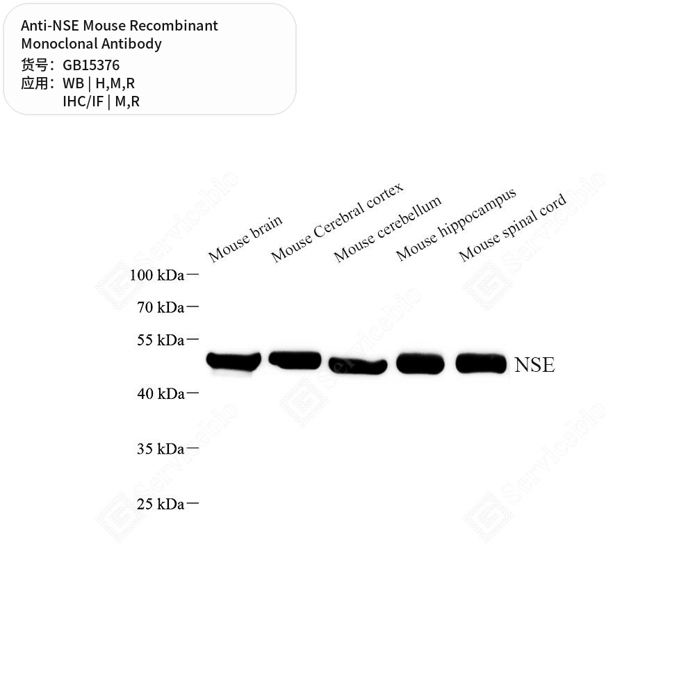 Антитела первичные, моноклональные мыши к NSE крысы, мыши, человека, 100 мкл