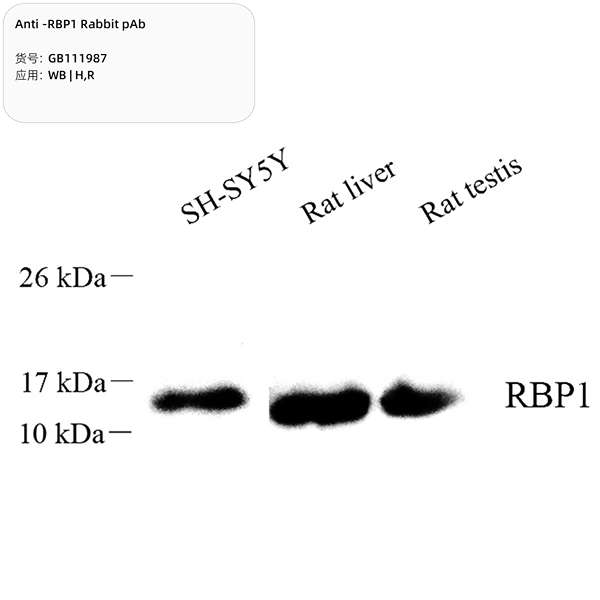 Антитела первичные, поликлональные, RBP1, 100 мкл