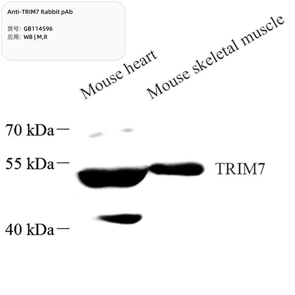 Антитела первичные, поликлональные, TRIM7, 100 мкл