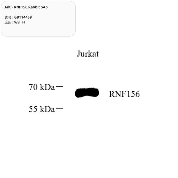 Антитела первичные, поликлональные, RNF156, 100 мкл