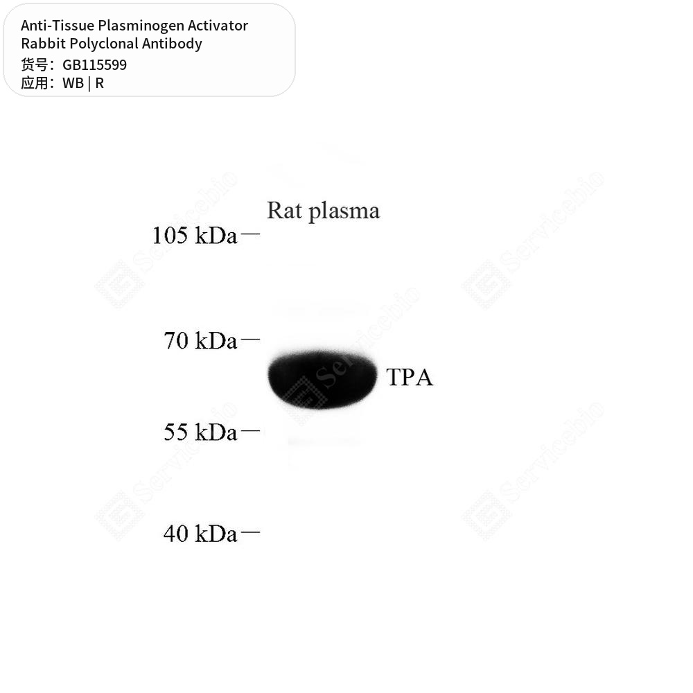 Антитела первичные, поликлональные кролика к Tissue Plasminogen Activator крысы, 100 мкл