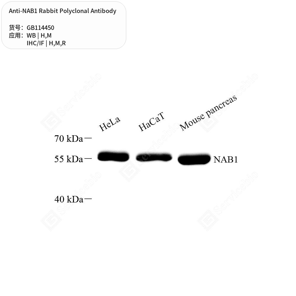 Антитела первичные, поликлональные кролика к NAB1 крысы, мыши, человека, 100 мкл