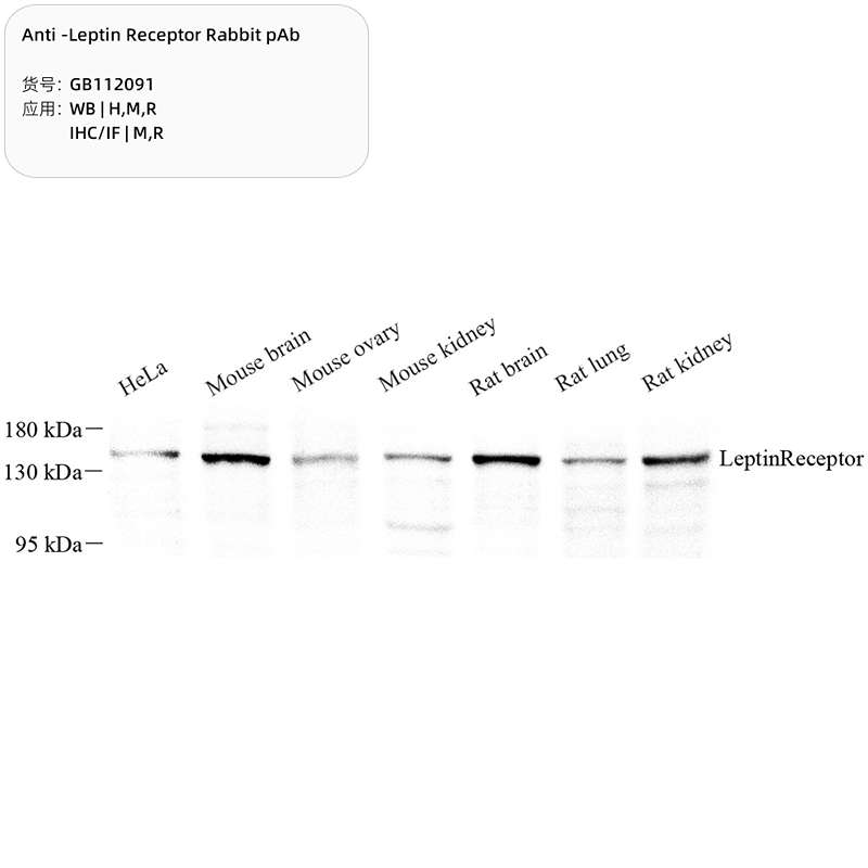 Антитела первичные, поликлональные, Leptin Receptor, 100 мкл
