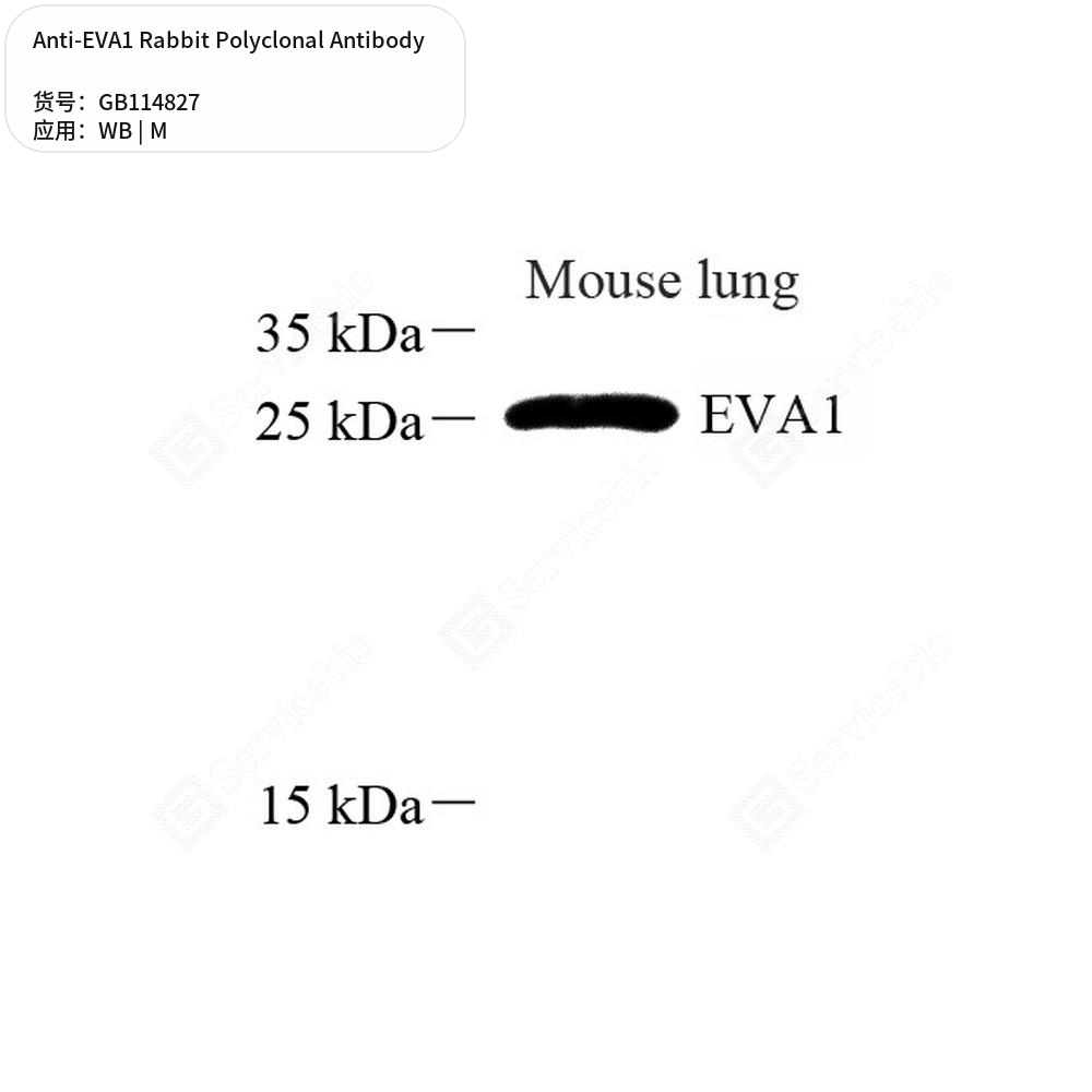 Антитела первичные, поликлональные кролика к EVA1 мыши, 100 мкл