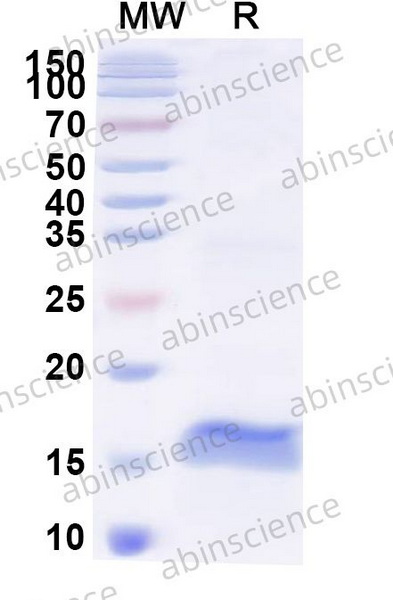 Наноантитела SERPINE1/PAI-1 (SAA0793), 100 мкг