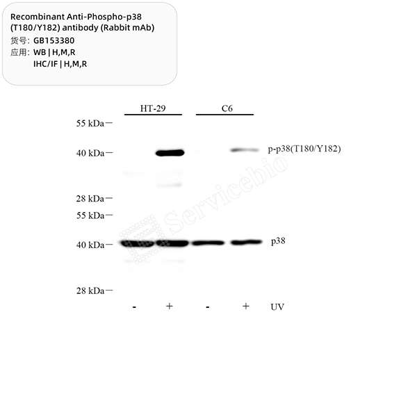 Антитела первичные, моноклональные, Phospho-p38 (T180/Y182), 100 мкл