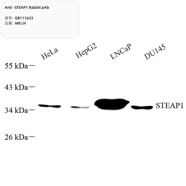 Антитела первичные, поликлональные, STEAP1, 100 мкл