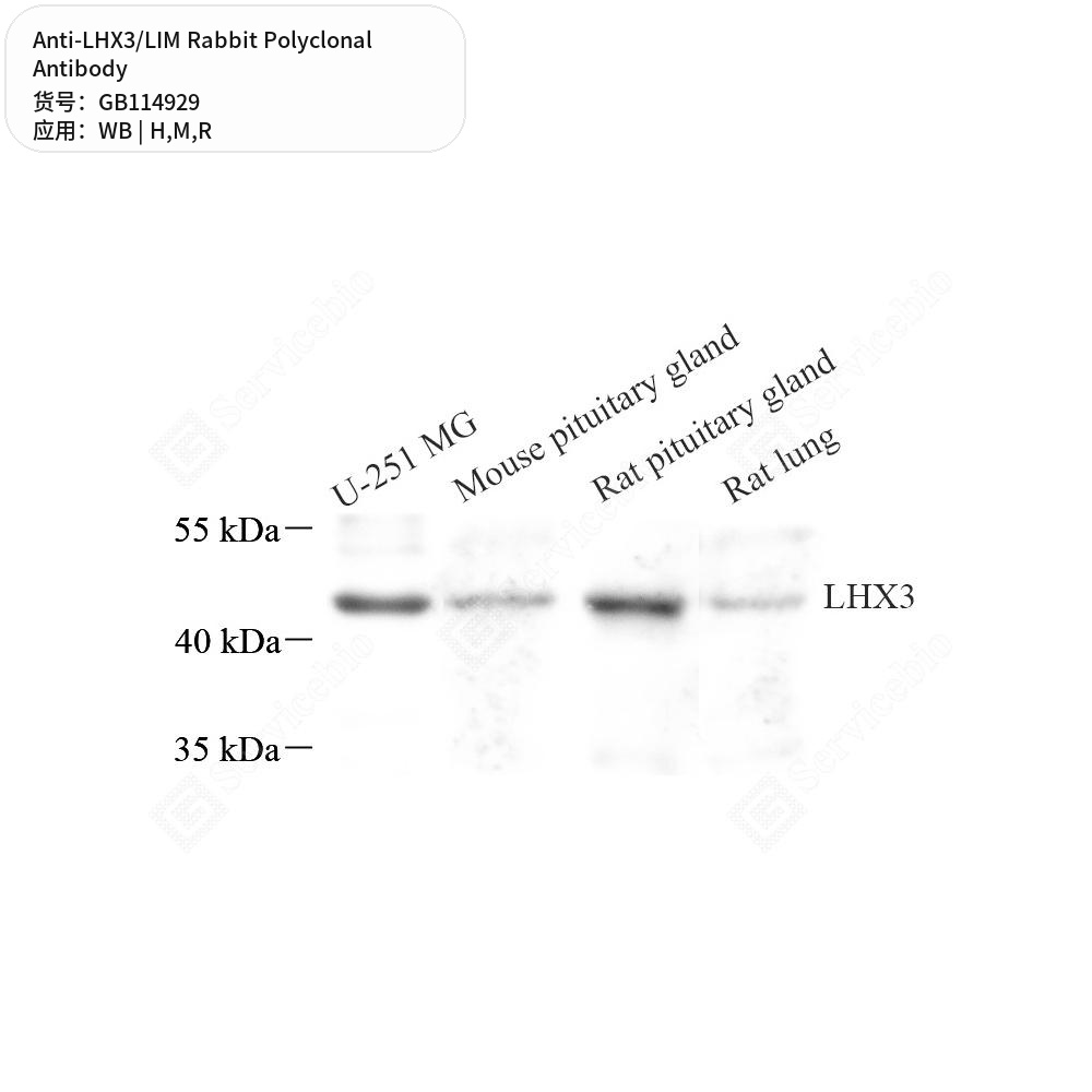 Антитела первичные, поликлональные кролика к LHX3/LIM крысы, мыши, человека, 50 мкл