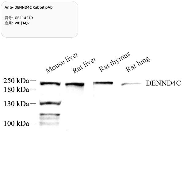 Антитела первичные, поликлональные, DENND4C, 100 мкл