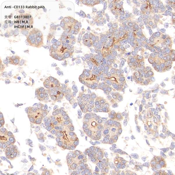 Антитела первичные, поликлональные, CD133, 100 мкл