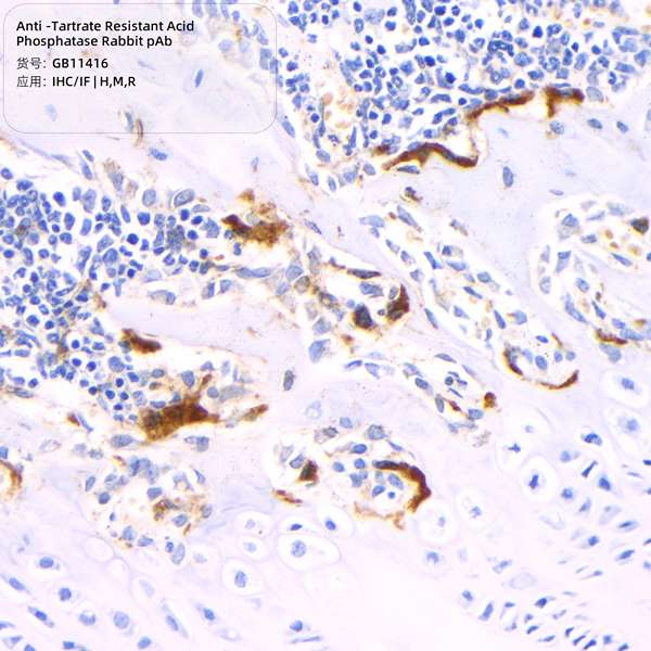 Антитела первичные, поликлональные, Tartrate Resistant Acid Phosphatase, 100 мкл