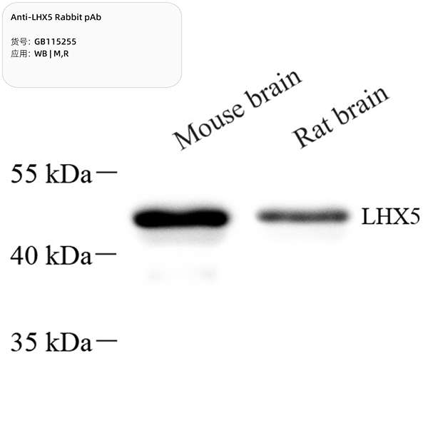 Антитела первичные, поликлональные, LHX5, 100 мкл
