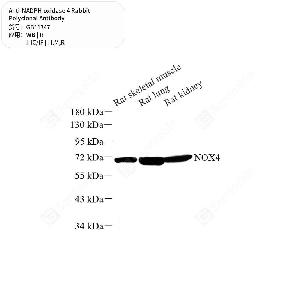 Антитела первичные, поликлональные кролика к NADPH oxidase 4 крысы, мыши, человека, 100 мкл