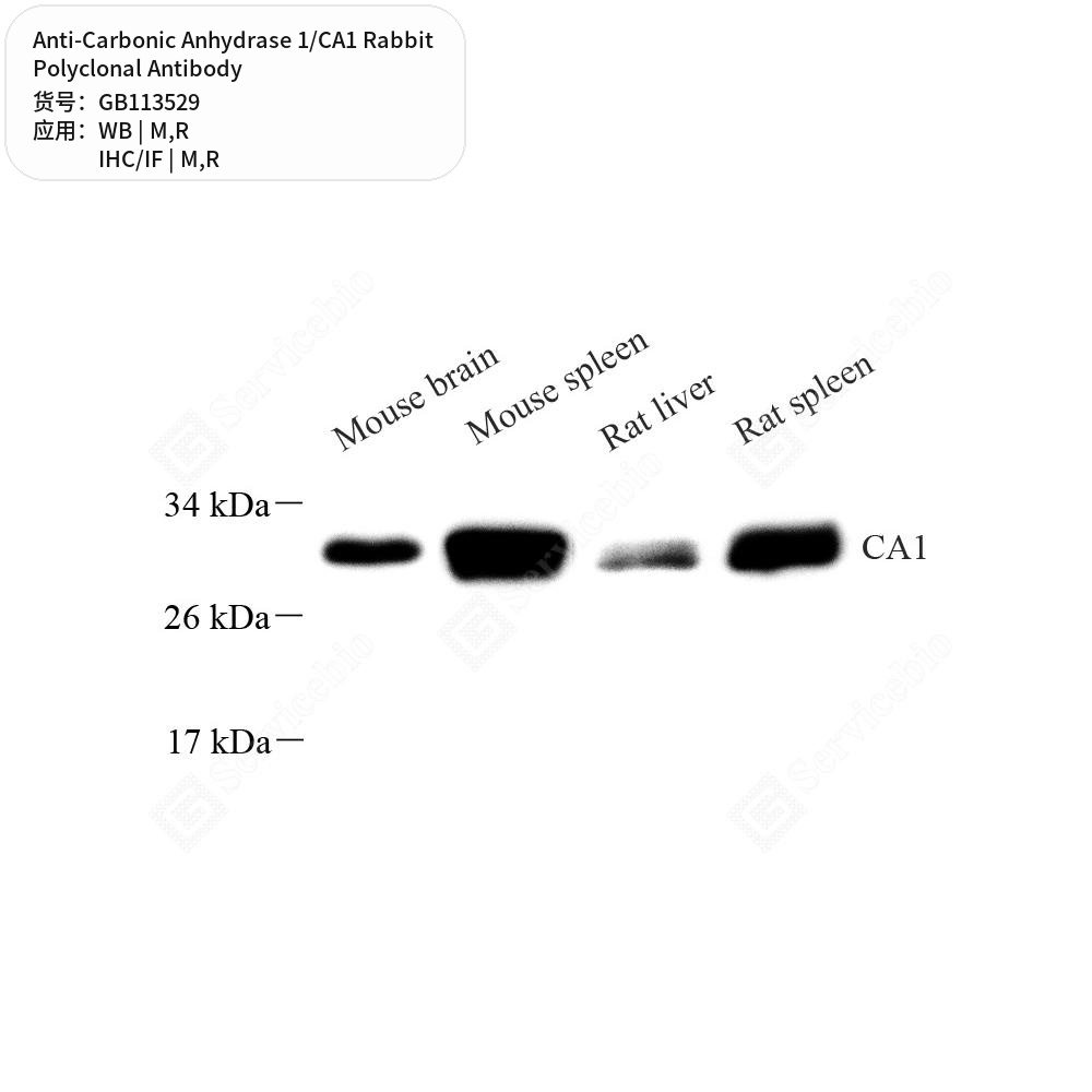 Антитела первичные, поликлональные кролика к Carbonic Anhydrase 1/CA1 крысы, мыши, 100 мкл