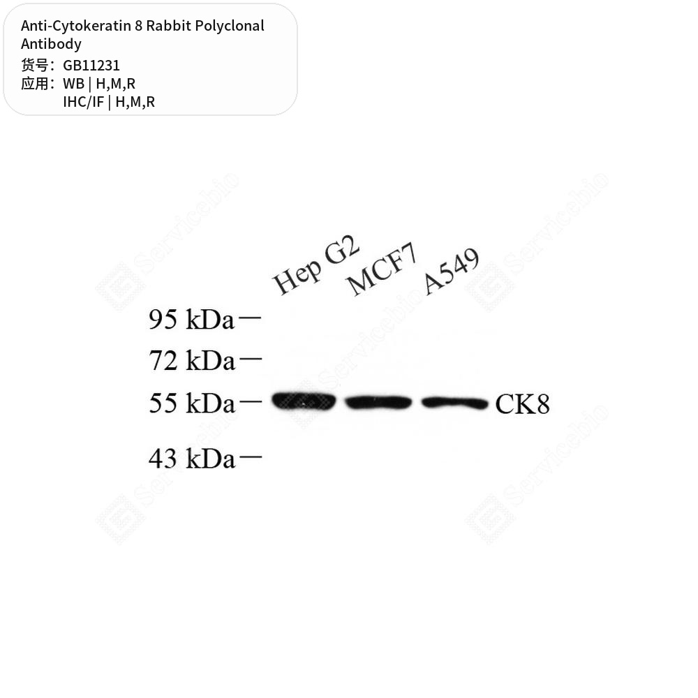 Антитела первичные, поликлональные кролика к Cytokeratin 8 крысы, мыши, человека, 100 мкл