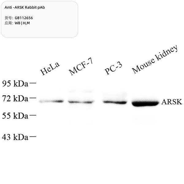 Антитела первичные, поликлональные, ARSK, 100 мкл