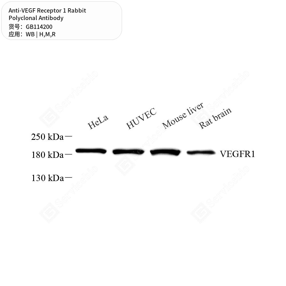 Антитела первичные, поликлональные кролика к VEGF Receptor 1 крысы, мыши, человека, 100 мкл