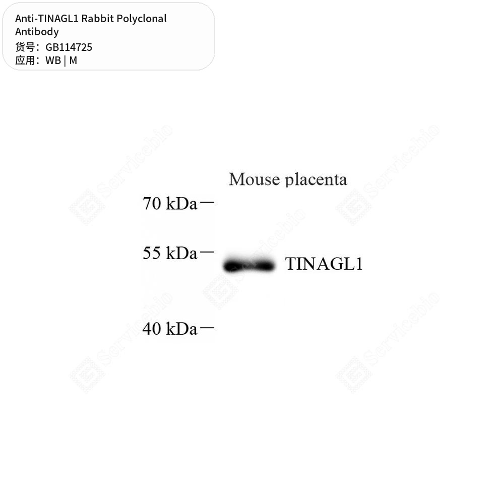 Антитела первичные, поликлональные кролика к TINAGL1 мыши, 100 мкл