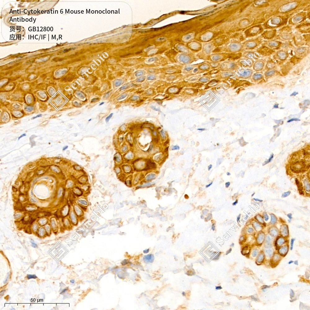 Антитела первичные, моноклональные мыши к Cytokeratin 6 крысы, мыши, 50 мкл