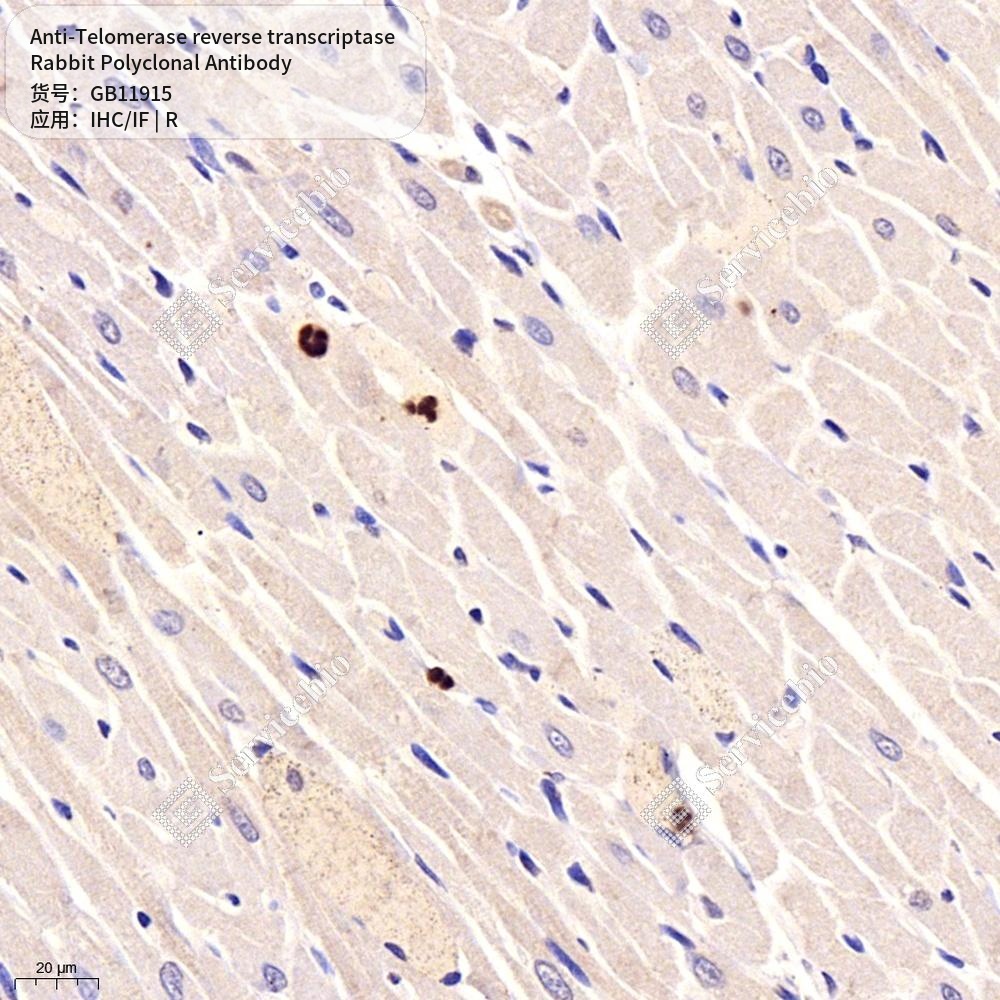 Антитела первичные, поликлональные кролика к Telomerase reverse transcriptase крысы, 50 мкл