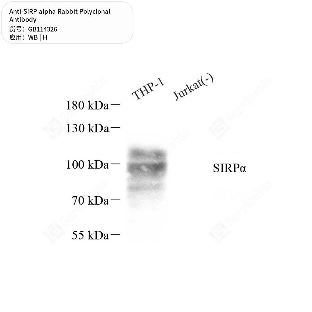Антитела первичные, поликлональные кролика к SIRP alpha человека, 50 мкл