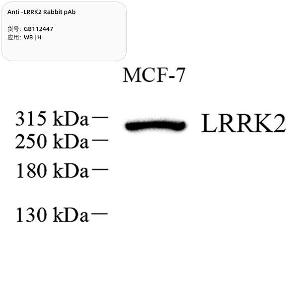 Антитела первичные, поликлональные, LRRK2, 100 мкл