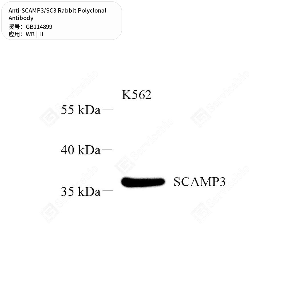 Антитела первичные, поликлональные кролика к SCAMP3/SC3 человека, 50 мкл