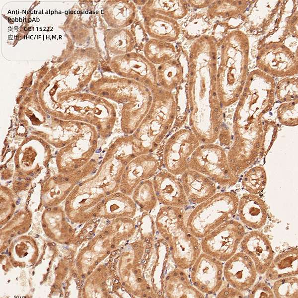 Антитела первичные, поликлональные, Neutral alpha-glucosidase C, 100 мкл