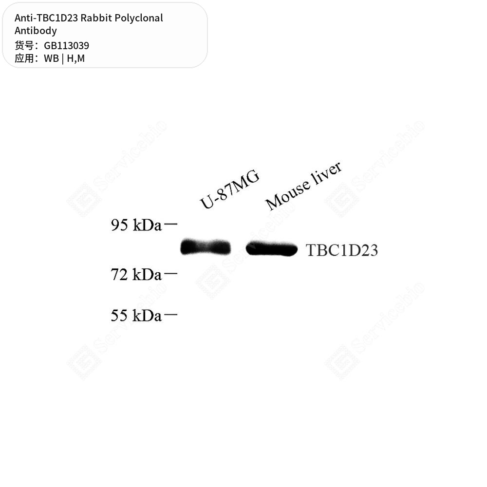 Антитела первичные, поликлональные кролика к TBC1D23 мыши, человека, 100 мкл