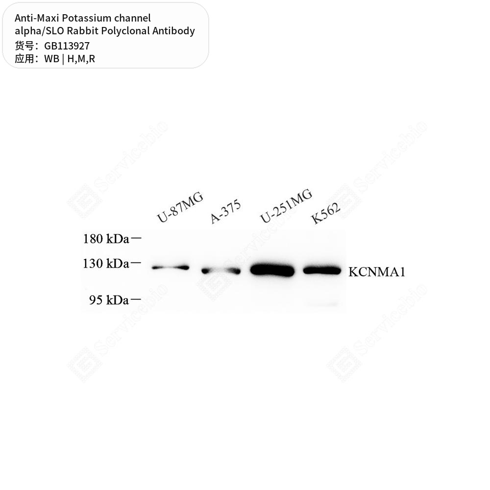Антитела первичные, пол. кролика к Maxi Potassium channel alpha/SLO крысы, мыши, человека, 50 мкл
