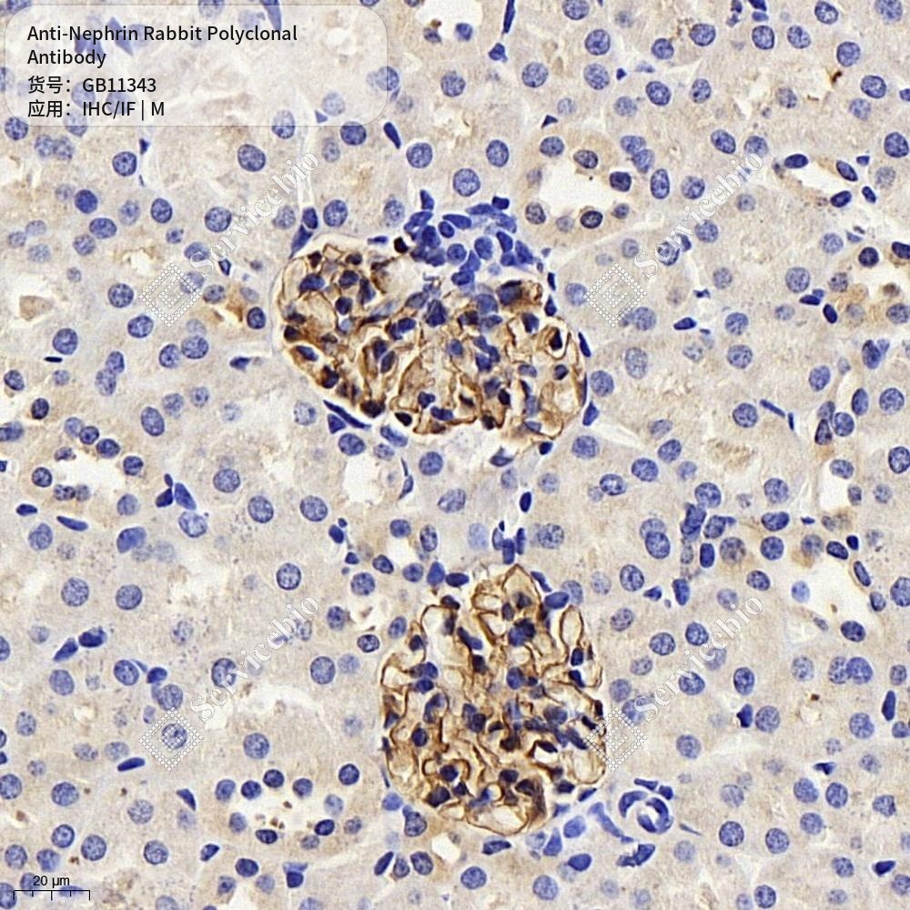 Антитела первичные, поликлональные кролика к Nephrin мыши, 50 мкл