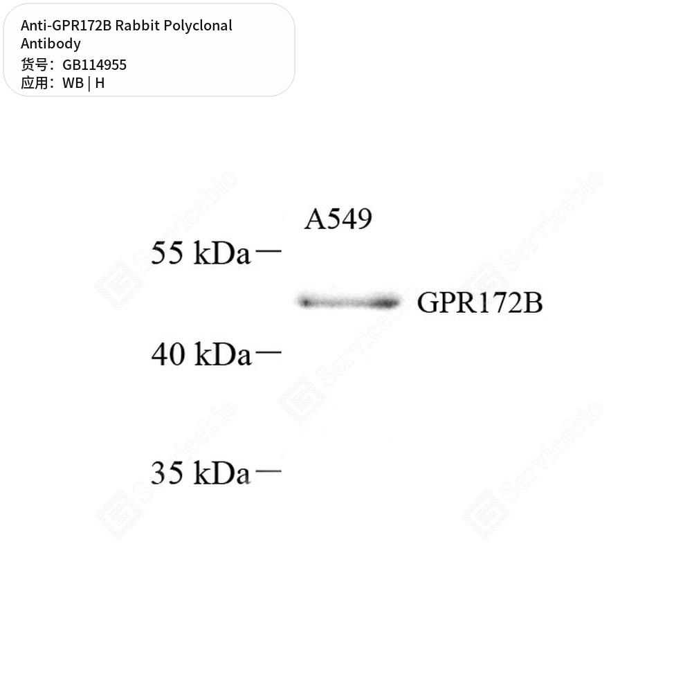 Антитела первичные, поликлональные кролика к GPR172B человека, 50 мкл