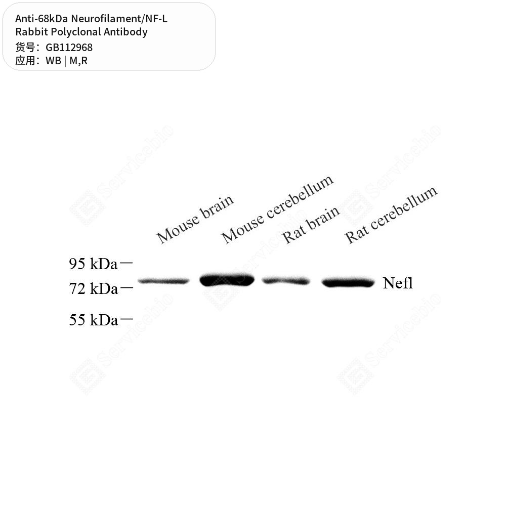 Антитела первичные, поликлональные кролика к 68kDa Neurofilament/NF-L крысы, мыши, 100 мкл