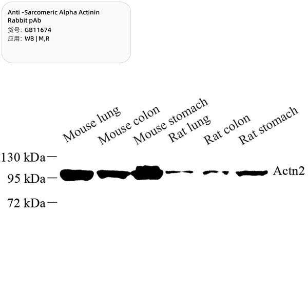 Антитела первичные, поликлональные, Sarcomeric alpha Actinin, 100 мкл