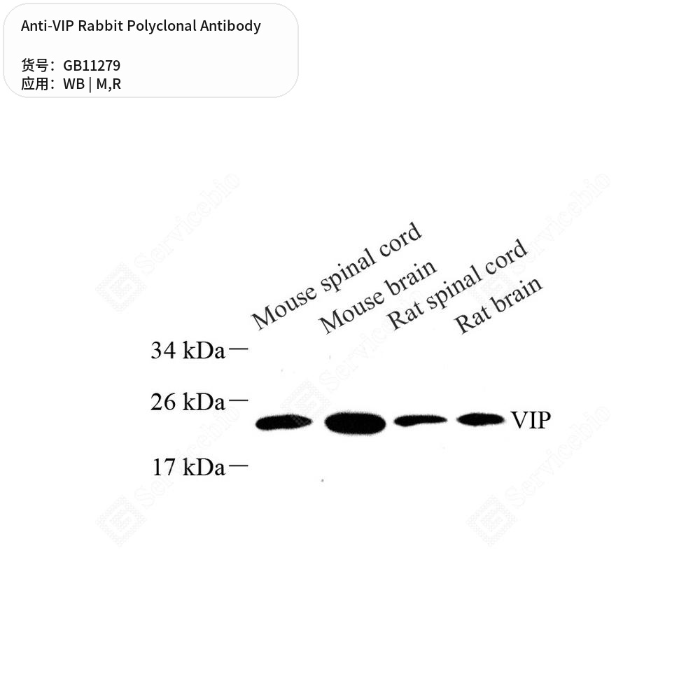 Антитела первичные, поликлональные кролика к VIP крысы, мыши, 100 мкл