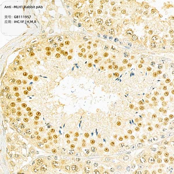 Антитела первичные, поликлональные, ULH1, 100 мкл